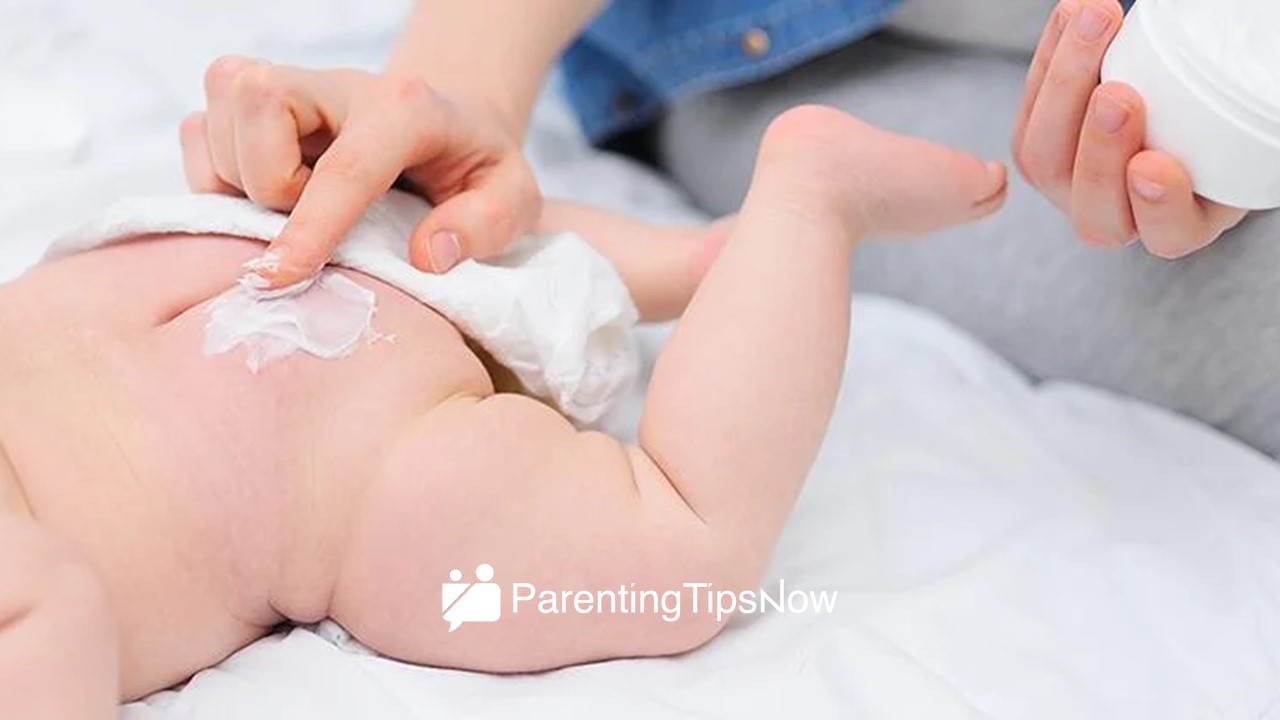 5 Types of Diaper Creams in the Philippines That Will Banish Rashes: From Aloe to Calendula