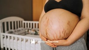 Avoid Stretch Marks During Pregnancy with Proper Diet